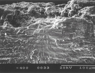 SEM photo of exfoliation corrosion as fatigue crack nucleation site in a high-strength aluminum alloy